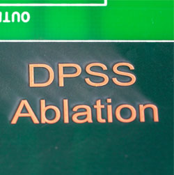 Laser ablation marking on pcb