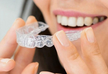 Women holding dental aligner